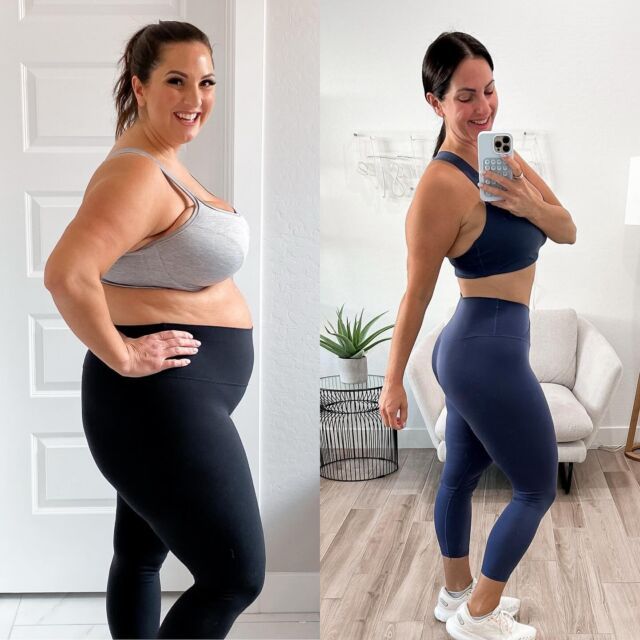 Cellulite reducing leggings: why they actually help
