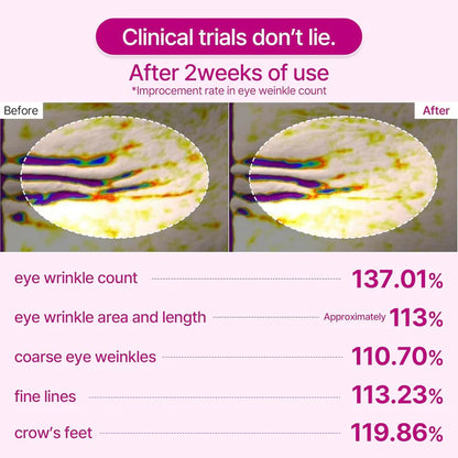 Anti-Falten Calcium-Kollagen-Augenpatches