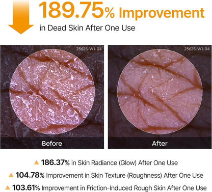 Peel Shot Kojic Acid + Turmeric Exfoliating Spray