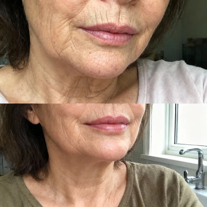 Anti-Aging Calcium-Erneuerungs-Gesichtsbalsam