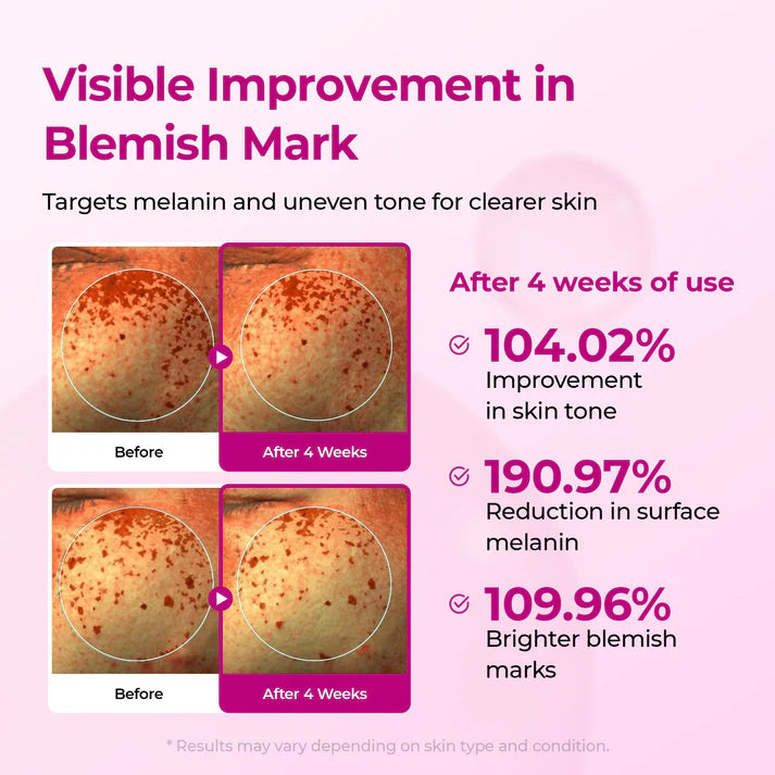 Korean Luminous Pore and Dark Spot Care Duo