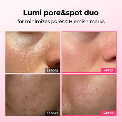 Korean Luminous Pore and Dark Spot Care Duo