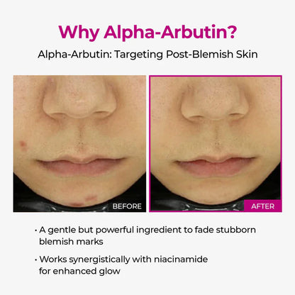 Korean Luminous Pore and Dark Spot Care Duo