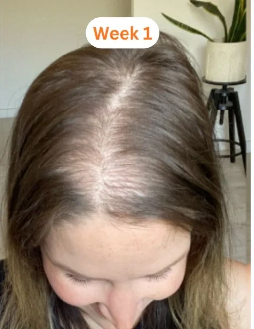 hair_before.png