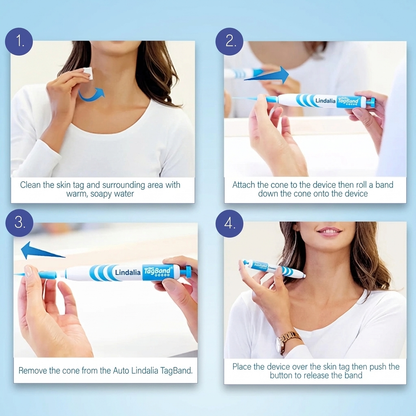 Skin Tag Removal Kit