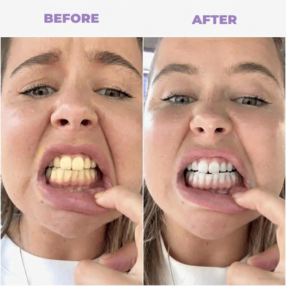 Purple Whitening Mouthwash