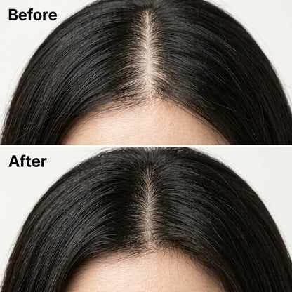 Lindalia Korean Scalp Revival Bar, before and after at the part line