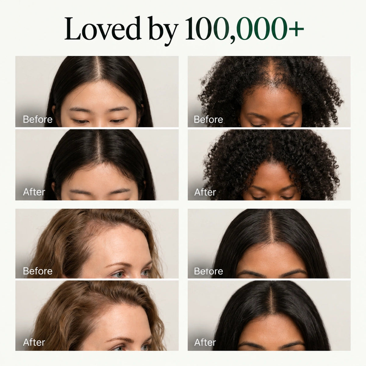Lindalia Korean Scalp Revival Bar